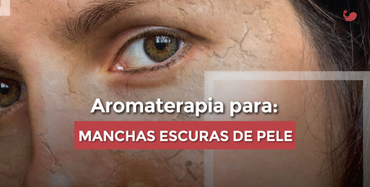 Aromaterapia Para Melasmas e Manchas Escuras na Pele